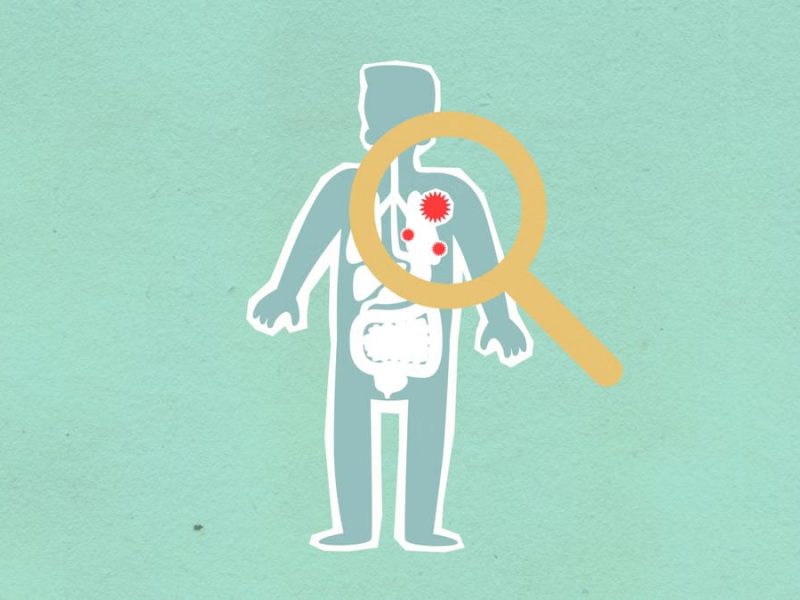 Paper cutout of man under magnifying glass with red viruses spreading on internal organs on green background during disease propagation